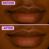 Zolo Facial Hair Removal Cream