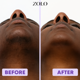 Zolo Facial Hair Removal Cream
